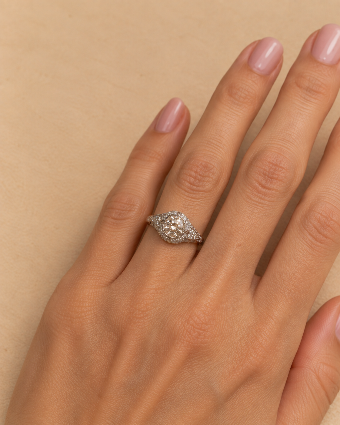 Anello 1920